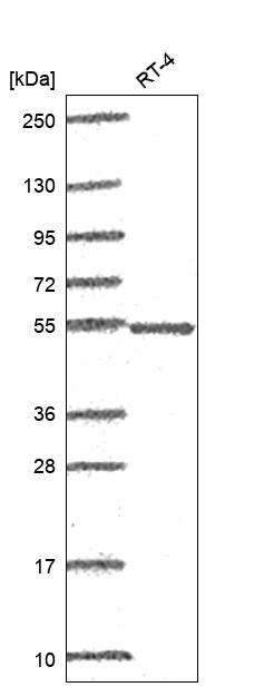 POLG2 Antibody Western Blot: POLG2 Antibody [NBP3-25059]