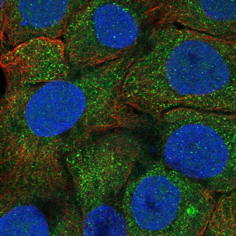 Profilin 3 Antibody Immunocytochemistry/Immunofluorescence: Profilin 3 Antibody [NBP3-25071]