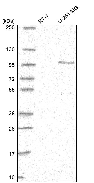 PSD-95 Antibody Western Blot: PSD-95 Antibody [NBP3-25075]