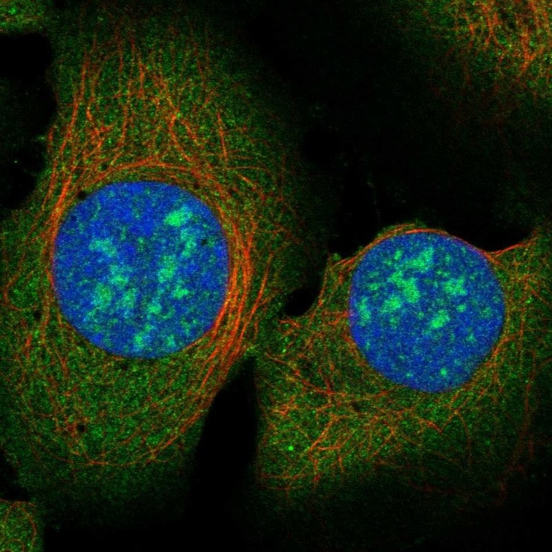 RAD51 Associated Protein 2 Antibody Immunocytochemistry/Immunofluorescence: RAD51 Associated Protein 2 Antibody [NBP3-25090]