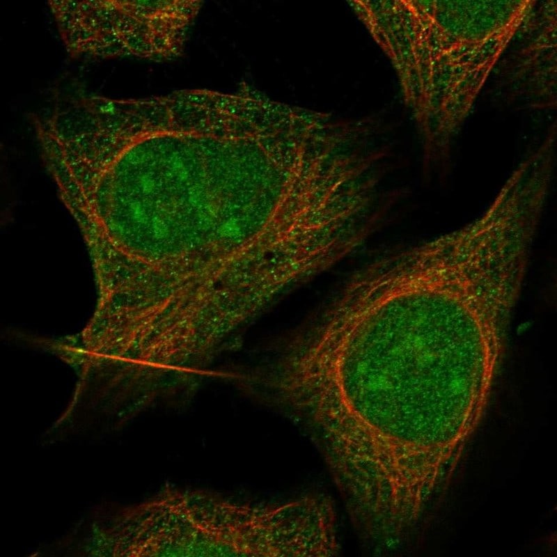 RLK/TXK Antibody Immunocytochemistry/Immunofluorescence: RLK/TXK Antibody [NBP3-25107]