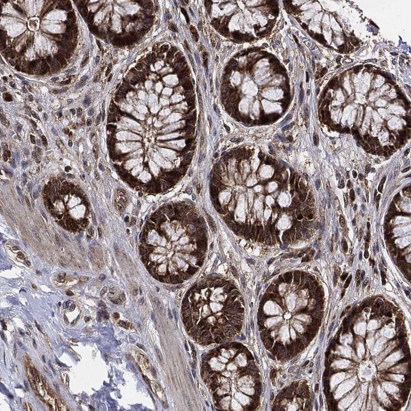RNase L Antibody Immunohistochemistry-Paraffin: RNase L Antibody [NBP3-25108]