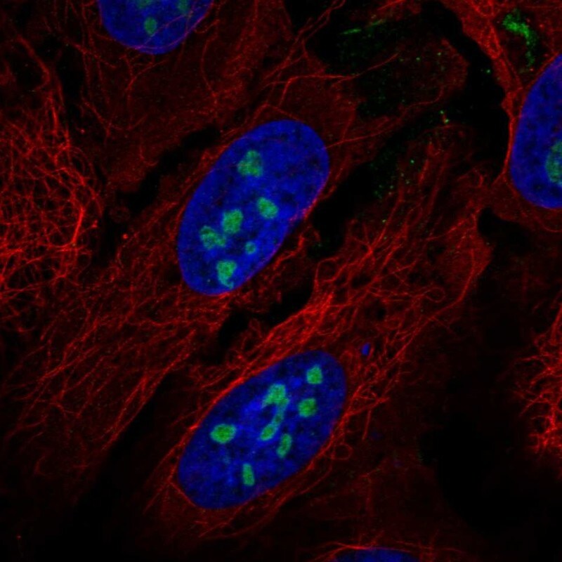 ROR alpha/NR1F1 Antibody Immunocytochemistry/Immunofluorescence: ROR alpha/NR1F1 Antibody [NBP3-25112]