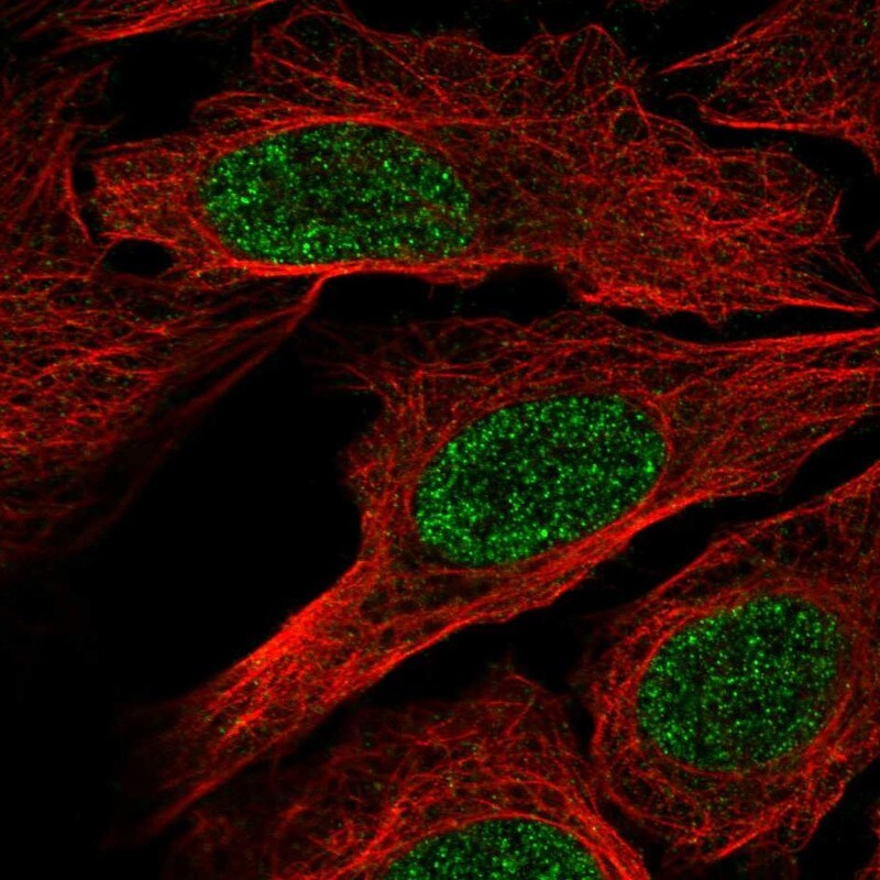 RXR beta/NR2B2 Antibody Immunocytochemistry/Immunofluorescence: RXR beta/NR2B2 Antibody [NBP3-25118]