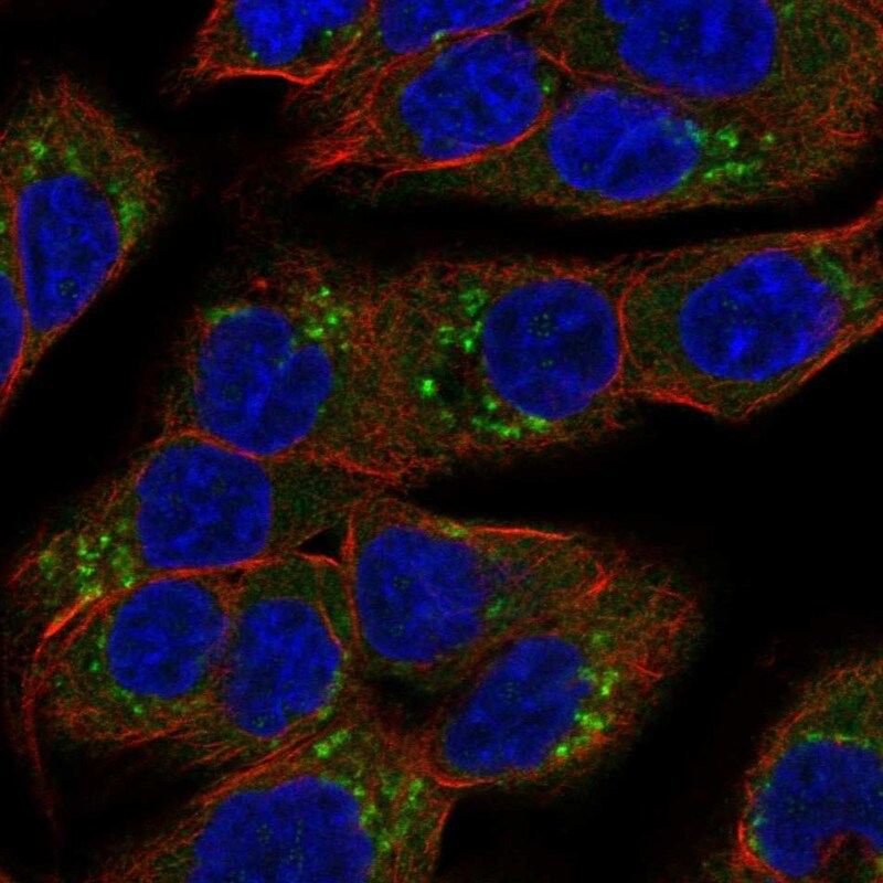 SCY1 like 3 Antibody Immunocytochemistry/Immunofluorescence: SCY1 like 3 Antibody [NBP3-25122]