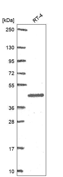 SerpinB2 Antibody Western Blot: SerpinB2 Antibody [NBP3-25132]