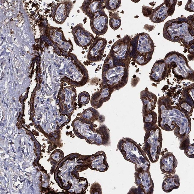 SerpinB2 Antibody Immunohistochemistry-Paraffin: SerpinB2 Antibody [NBP3-25132]