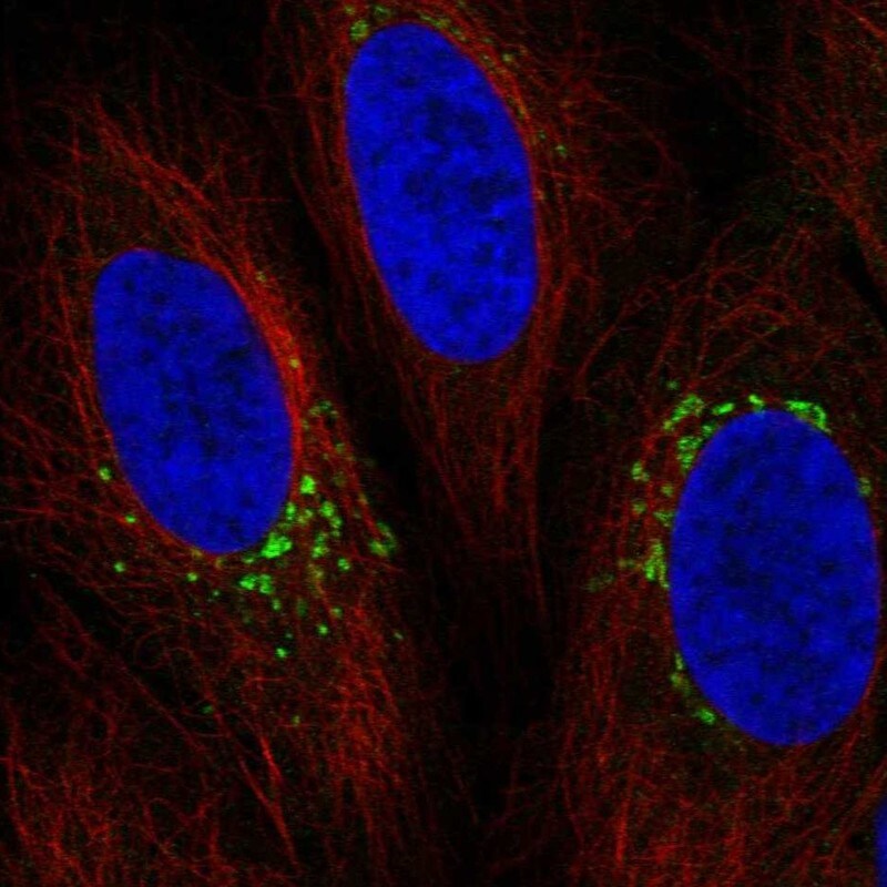 SH3BP2 Antibody Immunocytochemistry/Immunofluorescence: SH3BP2 Antibody [NBP3-25136]