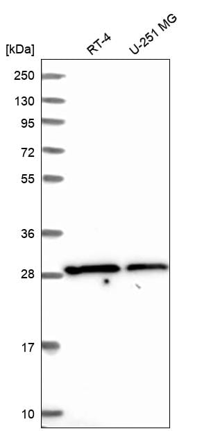 SLC25A45 Antibody Western Blot: SLC25A45 Antibody [NBP3-25142]