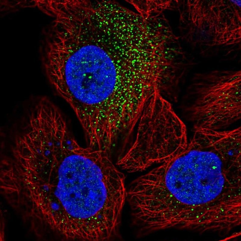 SorCS2 Antibody Immunocytochemistry/Immunofluorescence: SorCS2 Antibody [NBP3-25152]