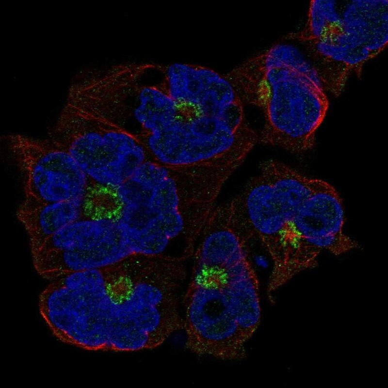 ST8 alpha-2,8-Sialyltransferase 4/ST8SIA4 Antibody Immunocytochemistry/Immunofluorescence: ST8 alpha-2,8-Sialyltransferase 4/ST8SIA4 Antibody [NBP3-25159]