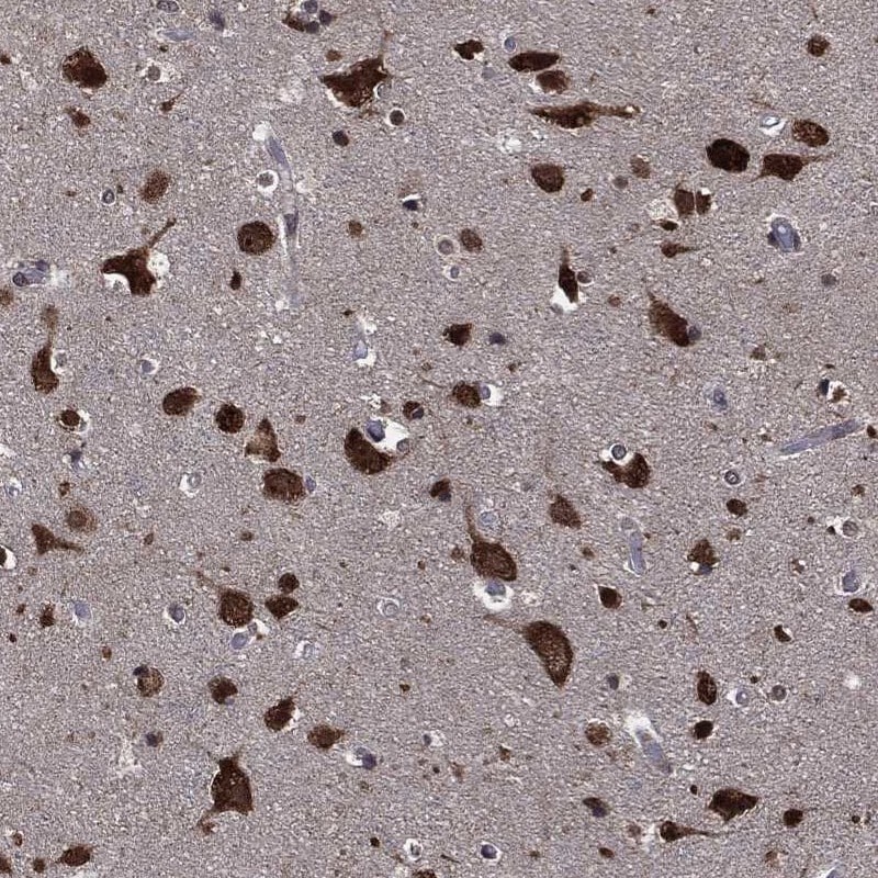 STAU2 Antibody Immunohistochemistry-Paraffin: STAU2 Antibody [NBP3-25161]