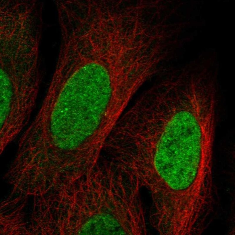 SUV420H2 Antibody Immunocytochemistry/Immunofluorescence: SUV420H2 Antibody [NBP3-25166]