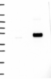 TBC1D13 Antibody Western Blot: TBC1D13 Antibody [NBP3-25172]
