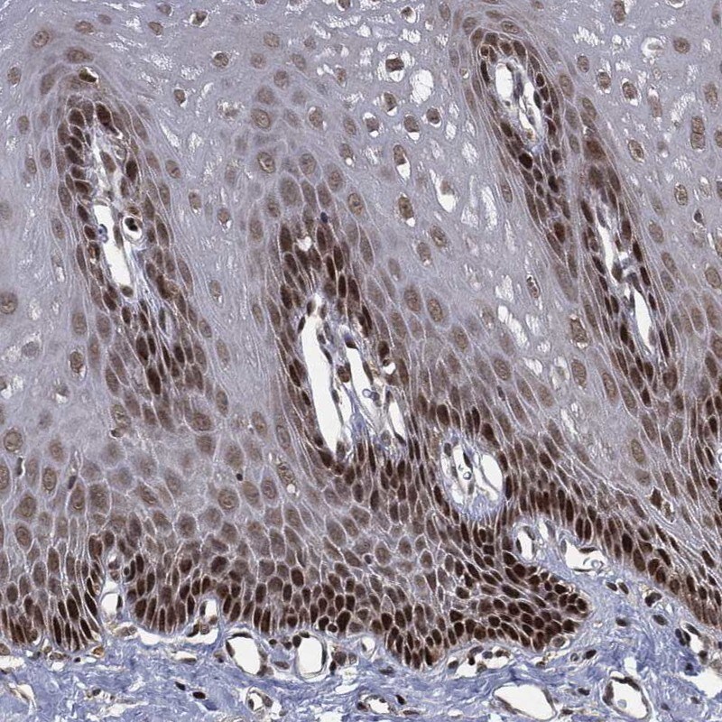 TBC1D22A Antibody Immunohistochemistry-Paraffin: TBC1D22A Antibody [NBP3-25173]