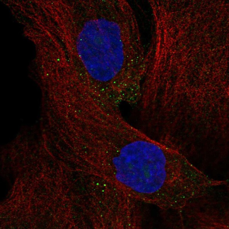 TCTEX1D4 Antibody Immunocytochemistry/Immunofluorescence: TCTEX1D4 Antibody [NBP3-25176]