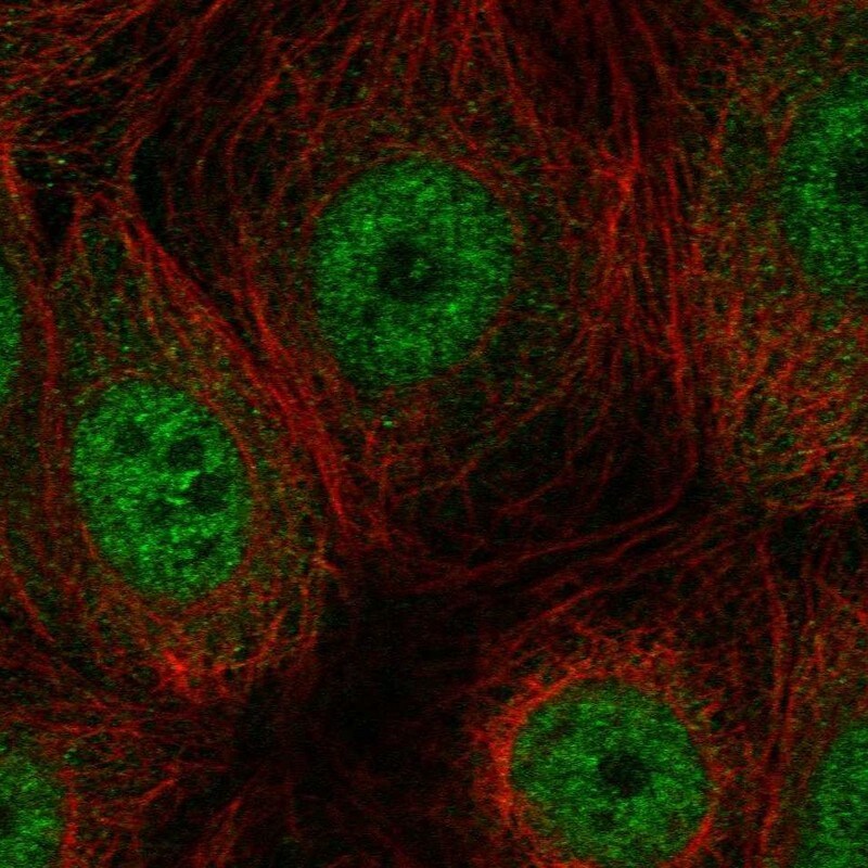 TEX49 Antibody Immunocytochemistry/Immunofluorescence: TEX49 Antibody [NBP3-25184]