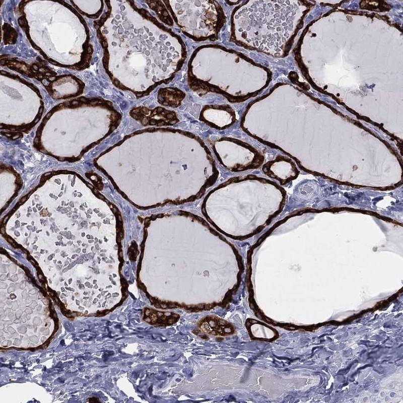 Thyroid Peroxidase Antibody Immunohistochemistry-Paraffin: Thyroid Peroxidase Antibody [NBP3-25190]
