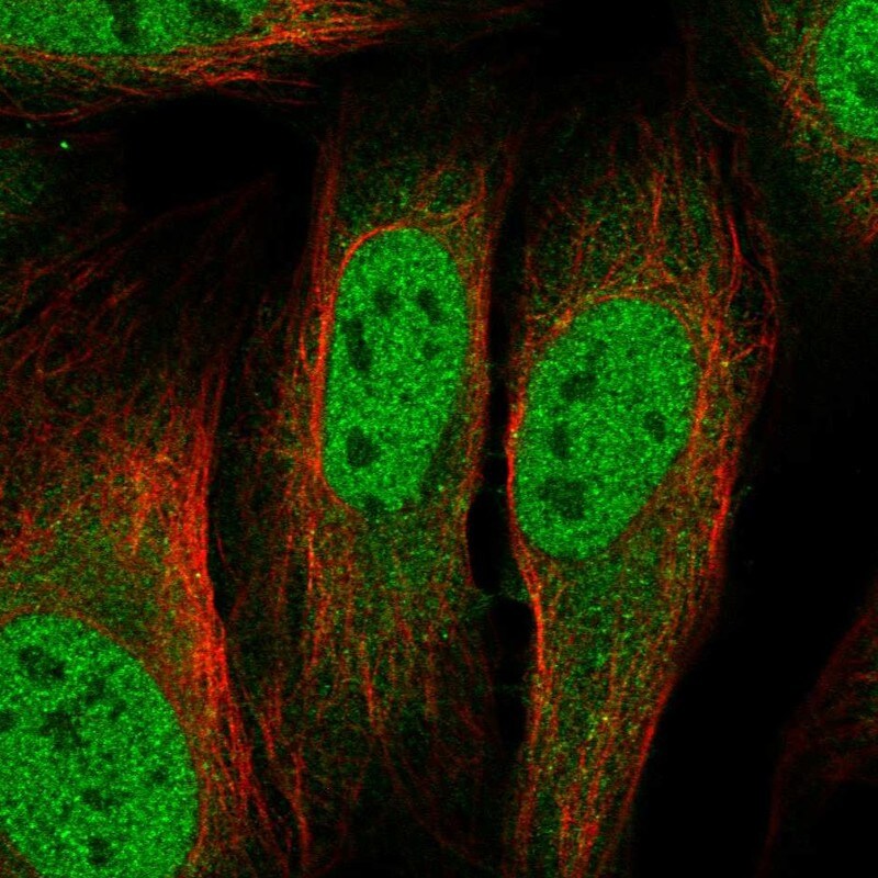 TIP60 Antibody Immunocytochemistry/Immunofluorescence: TIP60 Antibody [NBP3-25195]