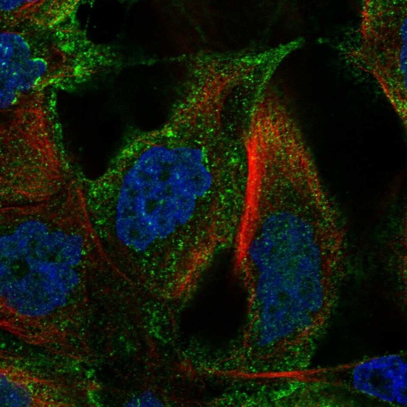 TM4SF18 Antibody Immunocytochemistry/Immunofluorescence: TM4SF18 Antibody [NBP3-25196]
