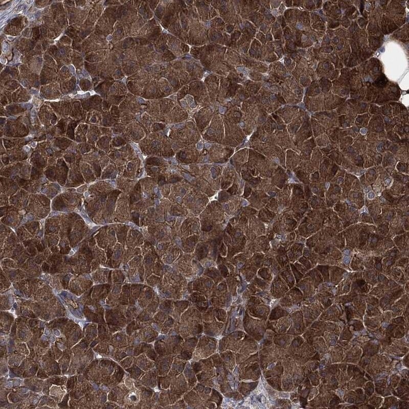 TPT1/TCTP Antibody Immunohistochemistry-Paraffin: TPT1/TCTP Antibody [NBP3-25204]