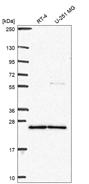 TPT1/TCTP Antibody Western Blot: TPT1/TCTP Antibody [NBP3-25204]