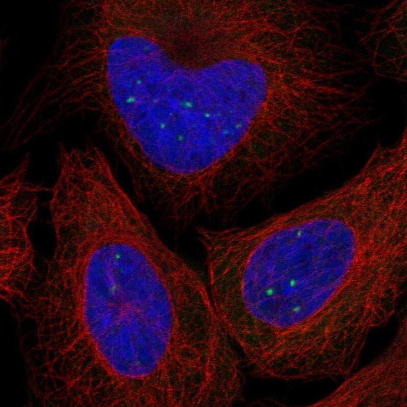 TTC9 Antibody Immunocytochemistry/Immunofluorescence: TTC9 Antibody [NBP3-25209]