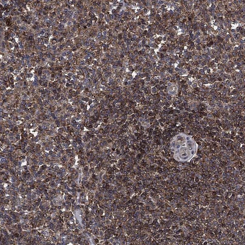 UBR1 Antibody Immunohistochemistry-Paraffin: UBR1 Antibody [NBP3-25214]