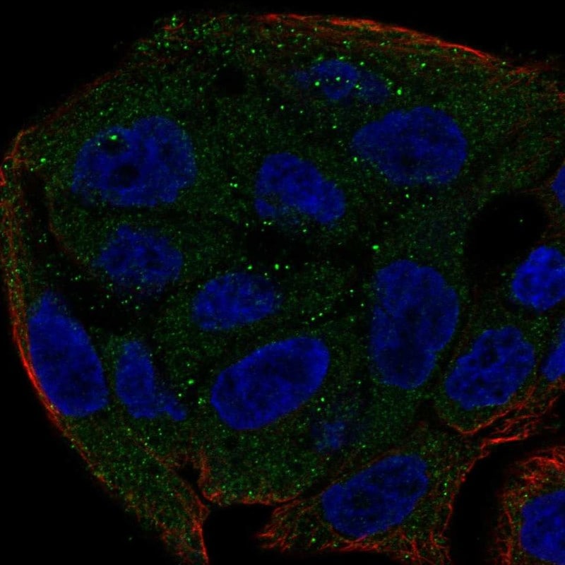 UGT1A6 Antibody Immunocytochemistry/Immunofluorescence: UGT1A6 Antibody [NBP3-25216]