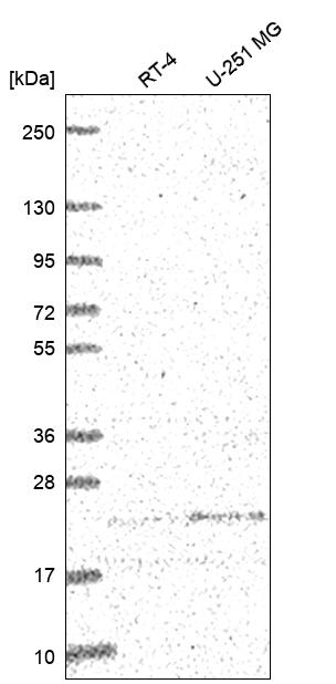 ULBP-2 Antibody Western Blot: ULBP-2 Antibody [NBP3-25217]