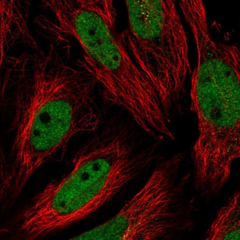 USF1 Antibody Immunocytochemistry/Immunofluorescence: USF1 Antibody [NBP3-25219]