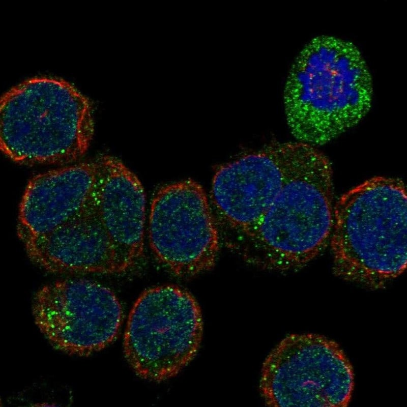 VEGFR2/KDR/Flk-1 Antibody Immunocytochemistry/Immunofluorescence: VEGFR2/KDR/Flk-1 Antibody [NBP3-25223]