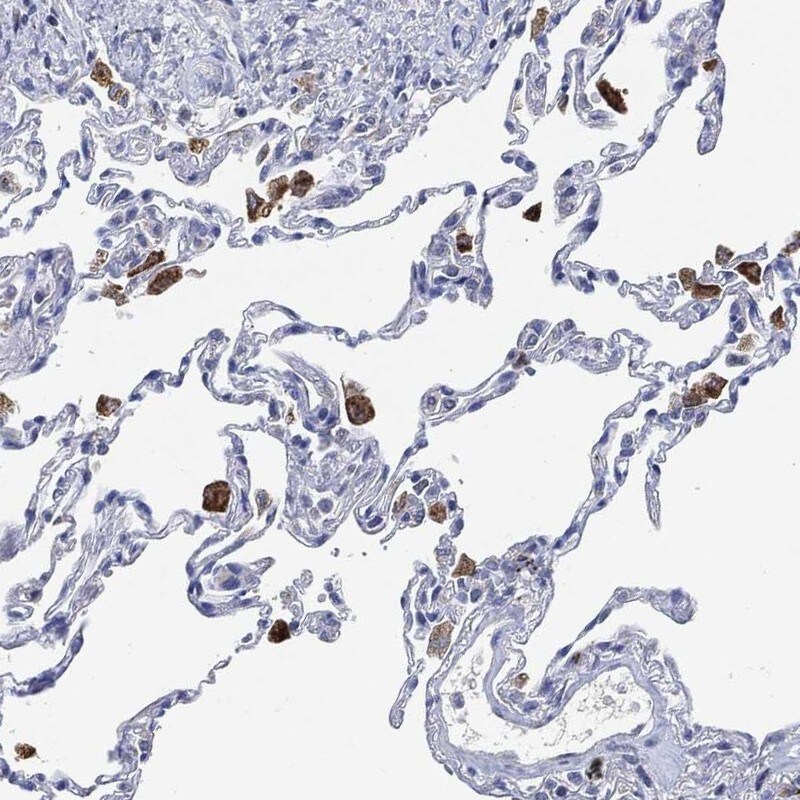 VSIG4 Antibody Immunohistochemistry-Paraffin: VSIG4 Antibody [NBP3-25227]