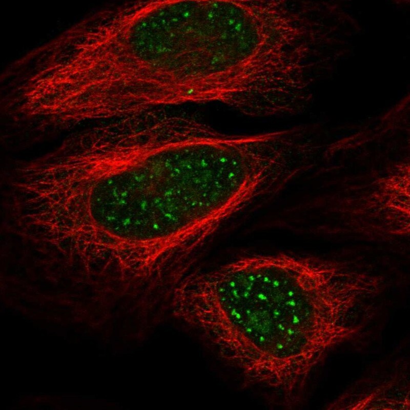 WRN Antibody Immunocytochemistry/Immunofluorescence: WRN Antibody [NBP3-25234]