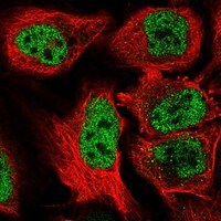 WSTF Antibody Immunocytochemistry/Immunofluorescence: WSTF Antibody [NBP3-25235]