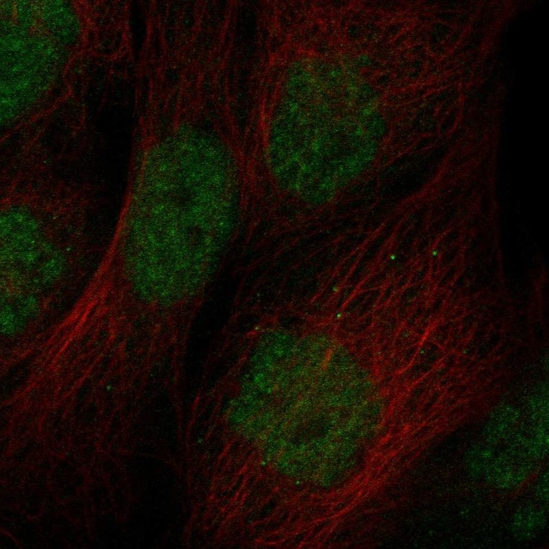 ZBTB46 Antibody Immunocytochemistry/Immunofluorescence: ZBTB46 Antibody [NBP3-25237]