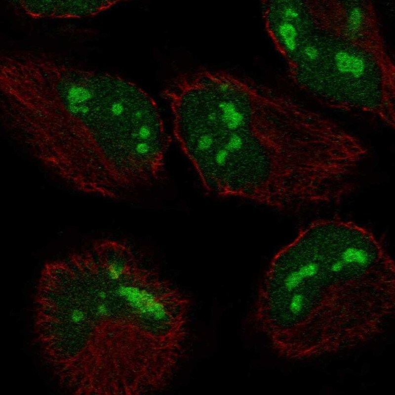 ZCCHC2 Antibody Immunocytochemistry/Immunofluorescence: ZCCHC2 Antibody [NBP3-25239]