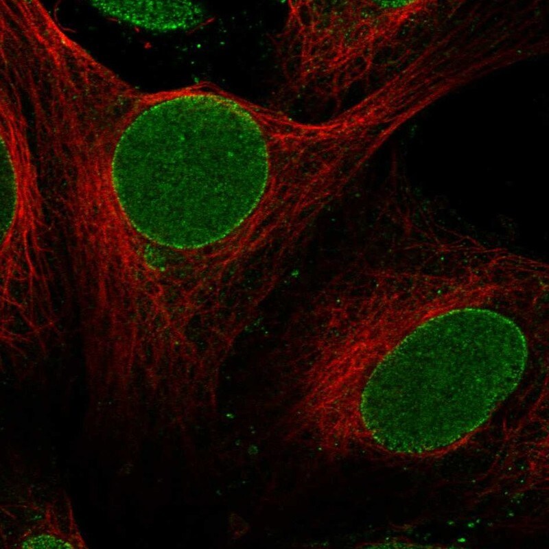ZNF20 Antibody Immunocytochemistry/Immunofluorescence: ZNF20 Antibody [NBP3-25246]