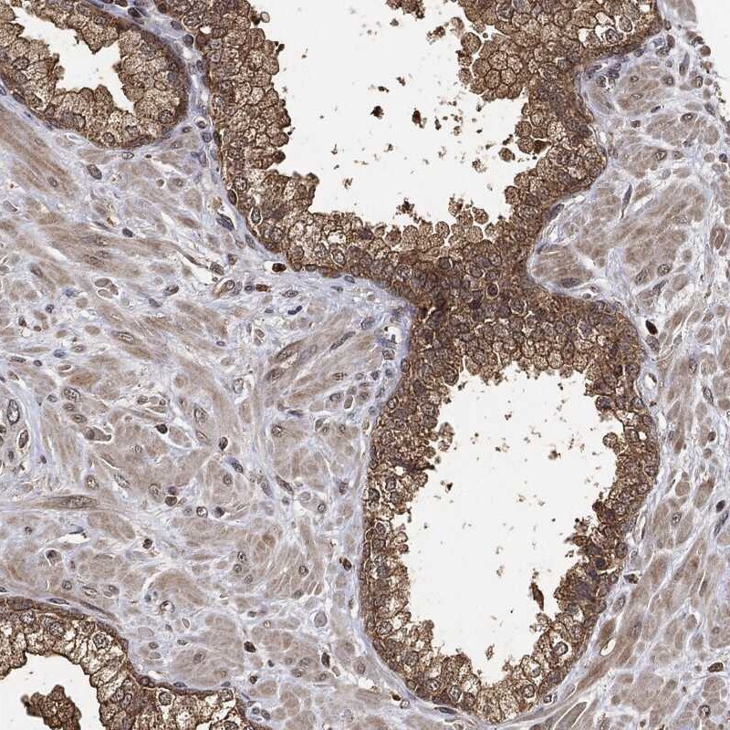 ZNF226 Antibody Immunohistochemistry-Paraffin: ZNF226 Antibody [NBP3-25248]