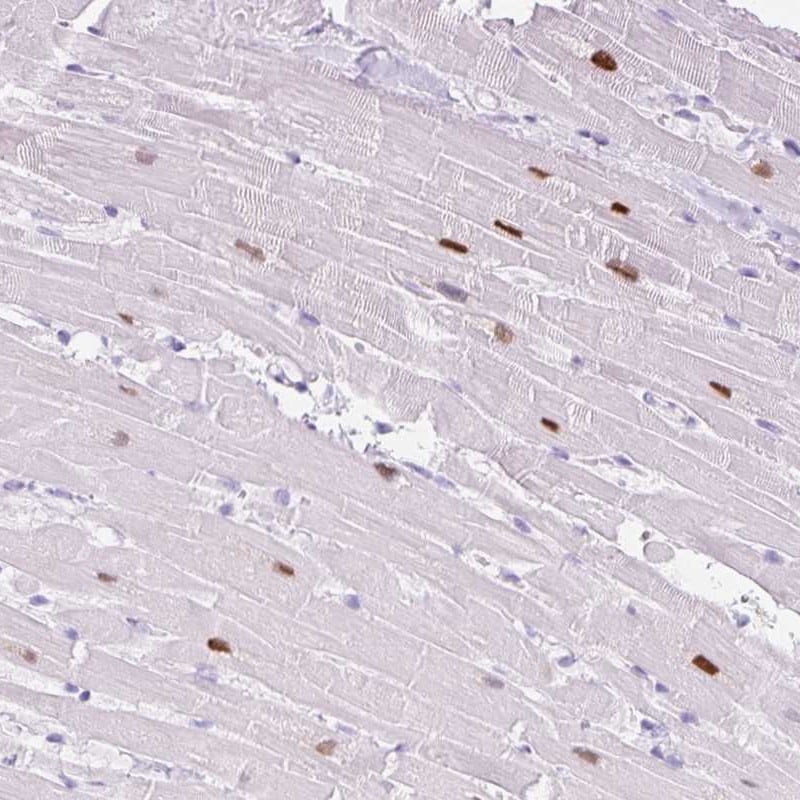 ADSSL1 Antibody Immunohistochemistry-Paraffin: ADSSL1 Antibody [NBP3-25267]