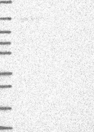 AF10 Antibody Western Blot: AF10 Antibody [NBP3-25268]
