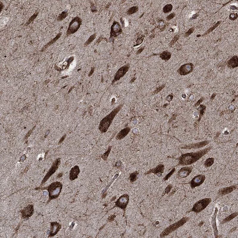 AMFR/gp78 Antibody Immunohistochemistry-Paraffin: AMFR/gp78 Antibody [NBP3-25274]