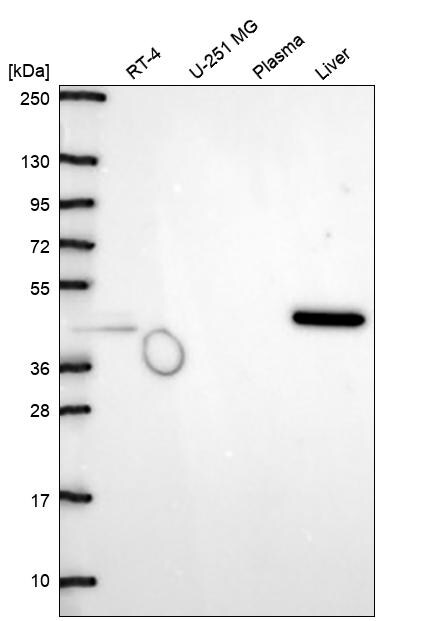 Aminoacylase/ACY1 Antibody Western Blot: Aminoacylase/ACY1 Antibody [NBP3-25276]