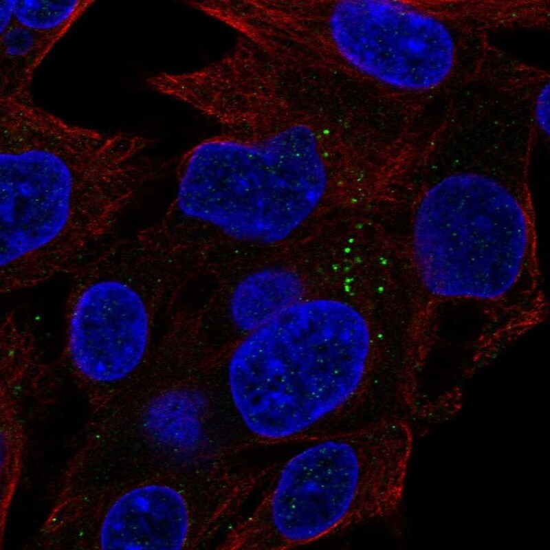 Aminoacylase/ACY1 Antibody Immunocytochemistry/Immunofluorescence: Aminoacylase/ACY1 Antibody [NBP3-25276]