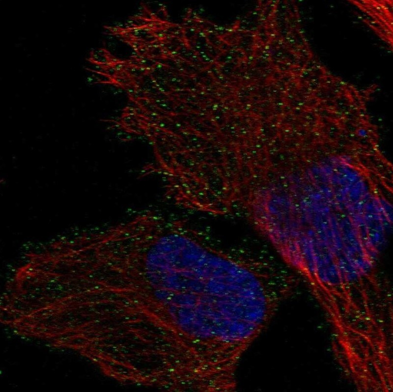 AP1M2 Antibody Immunocytochemistry/Immunofluorescence: AP1M2 Antibody [NBP3-25278]
