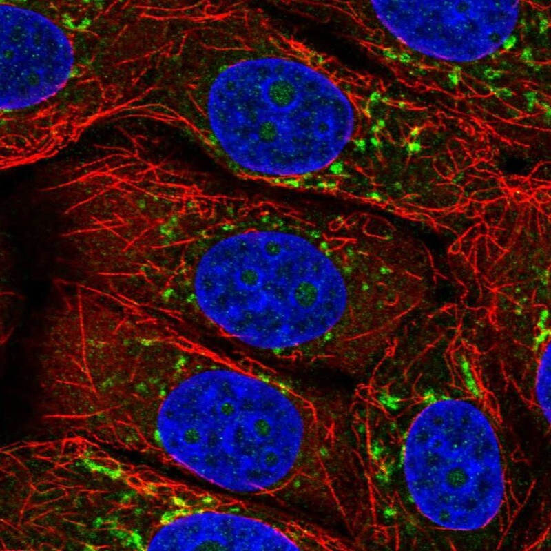 ARFIP2 Antibody Immunocytochemistry/Immunofluorescence: ARFIP2 Antibody [NBP3-25281]