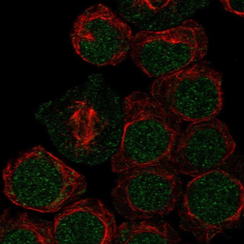 ARID2 Antibody Immunocytochemistry/Immunofluorescence: ARID2 Antibody [NBP3-25285]