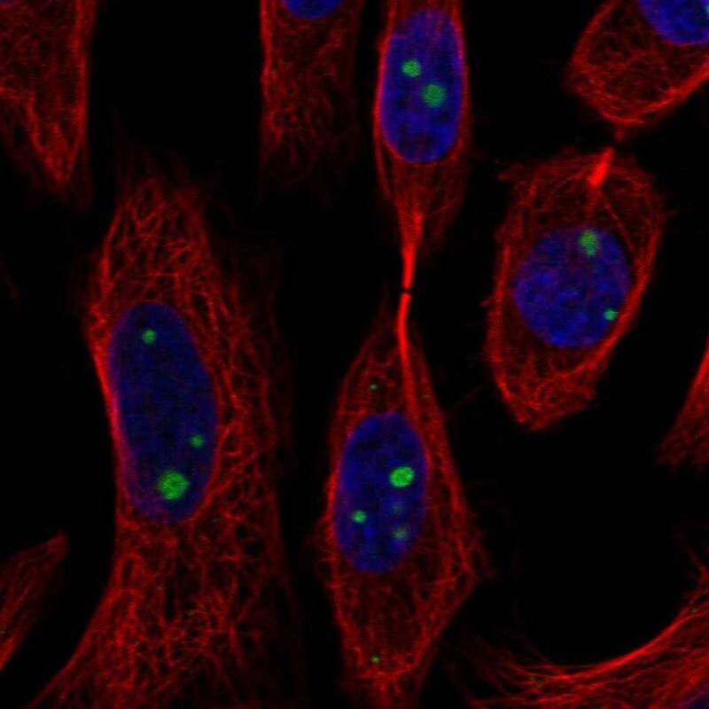 Axin-1 Antibody Immunocytochemistry/Immunofluorescence: Axin-1 Antibody [NBP3-25292]