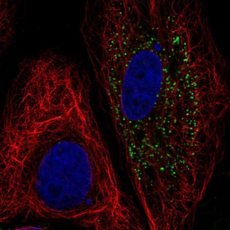 B4GALT5 Antibody Immunocytochemistry/Immunofluorescence: B4GALT5 Antibody [NBP3-25294]