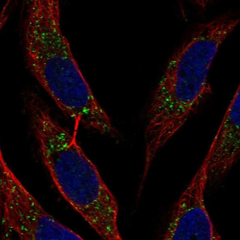 BST2 Antibody Immunocytochemistry/Immunofluorescence: BST2 Antibody [NBP3-25305]